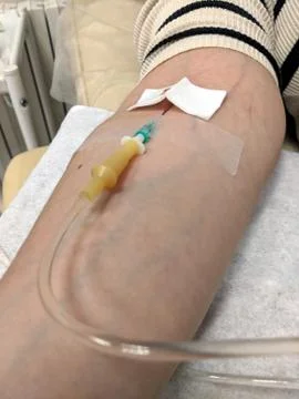 IV needle in arm Stock Photos