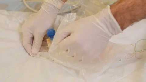 Iv preperations Stock Footage 72324387