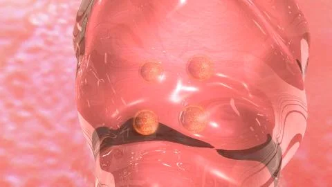 IVF Embryo transfer Illustrazione stock