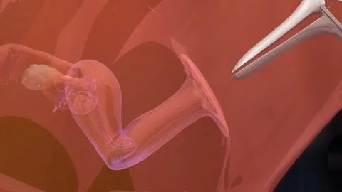 IVF Embryo transfer Illustrazione stock