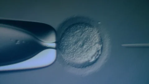 IVF, extracorporal fertilization process. Magnified artificial fertilization of Stock-Footage 119252653