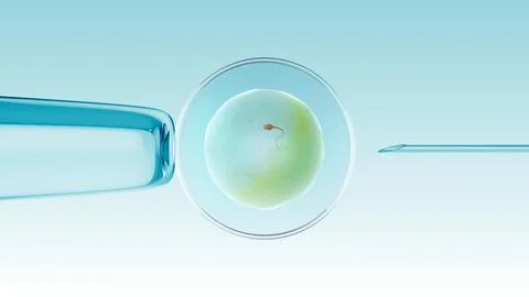 Ivf in vitro fertilization of an egg with a sperm イラスト素材