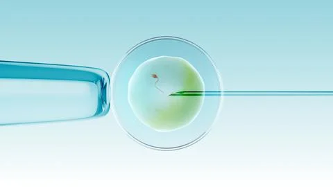 Ivf in vitro fertilization of an egg with a sperm イラスト素材