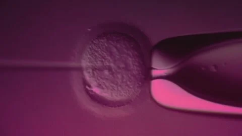 IVF in vitro fertilization microscopic view. Intracytoplasmic sperm injection Stock Footage 270441263