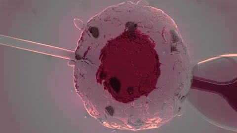 IVF in vitro fertilization microscopic view. Intracytoplasmic sperm injection Stock Footage 270441267