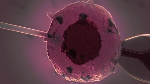 IVF in vitro fertilization microscopic view. Intracytoplasmic sperm injection Stock Footage 270441269