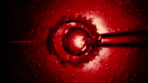IVF in vitro fertilization microscopic view. Intracytoplasmic sperm injection Stock Footage 270441278