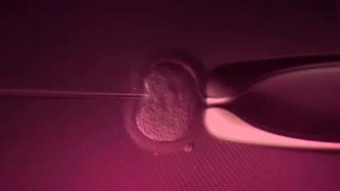 IVF in vitro fertilization microscopic view. Intracytoplasmic sperm injection Stock Footage 270441281