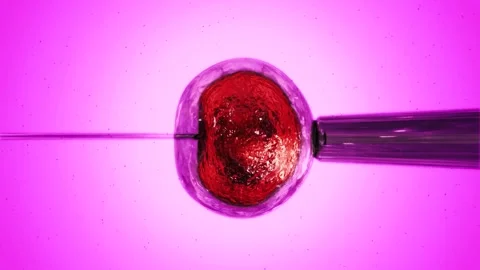 IVF in vitro fertilization microscopic view. Intracytoplasmic sperm injection Stock Footage 270441305