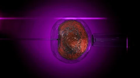 IVF in vitro fertilization microscopic view. Intracytoplasmic sperm injection Stock Footage 270441307