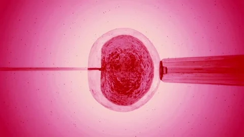 IVF in vitro fertilization microscopic view. Intracytoplasmic sperm injection Stock Footage 270441317