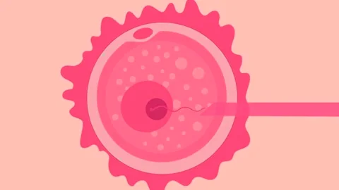 IVF in vitro fertilization microscopic view. Intracytoplasmic sperm injection Stock Footage 270441369