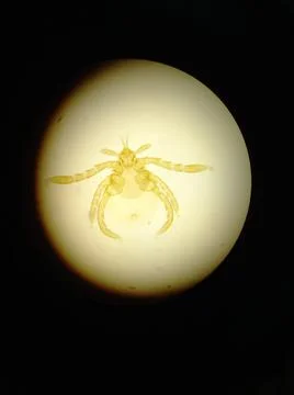 Ixodid tick under a microscope. Stock Photos