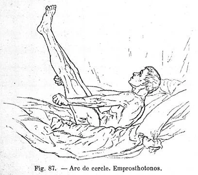 J. M. Charcot, Lecons du mardi, Paris: 1887 イラスト素材
