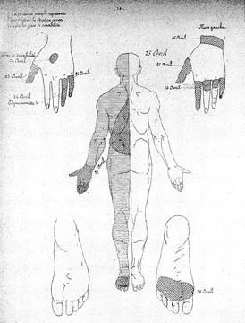J. M. Charcot, Lecons du mardi, Paris: 1887 イラスト素材