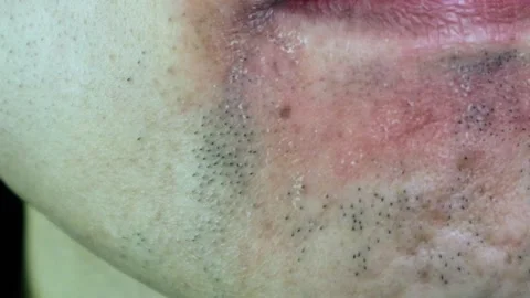 A Japanese man whose beard has thinned due to hair removal Stock Footage 325693841