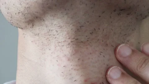 A Japanese man's neck immediately after beard removal Stock Footage 326088091