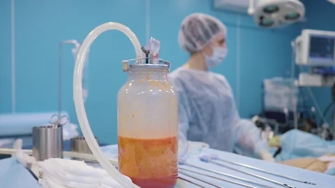 Jar for pumping fat. Filled with fat. Lipomodeling, liposation Stock Footage 124405883