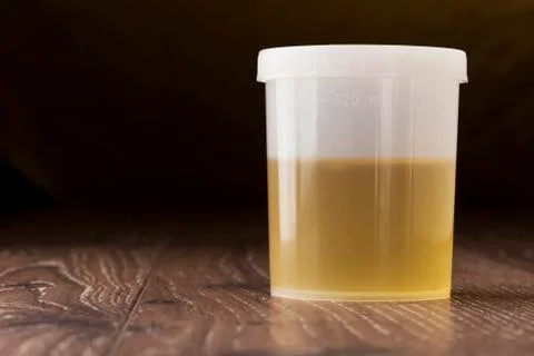 Jar of urine Stock Photos