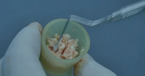 The jaw bone membrane preparation Video stock 70172780