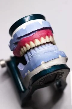 A jaw with ceramic teeth. Dentist's device Stock Photos