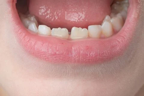 Jaw with children's straight teeth close-up. Stock Photos