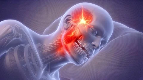 Jaw grinding during sleep and pain in human body 動画素材 346483755