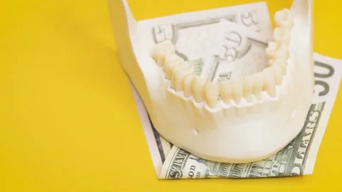 Jaw of a human with teeth and banknotes of money,dentistry implantation price 스톡 동영상 234144460