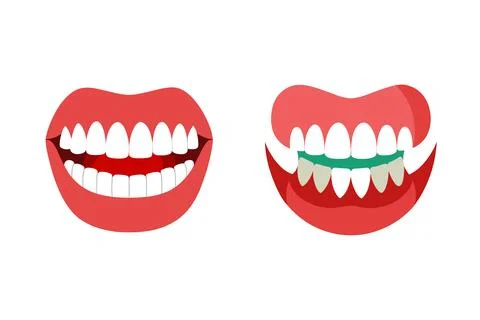 Jaw of human vector elements bundle Stock Illustration