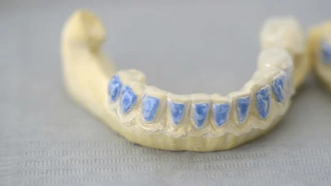 Jaw model with brace on table in clinic Stock Footage 89976457