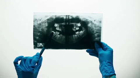 Jaw x-ray close-up. Magnetic Resonance Image of theeth. Doctor examining xray of Vídeo Stock 169197091