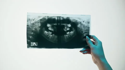Jaw x-ray close-up. Magnetic Resonance Image of theeth. Doctor examining xray of Stock Footage 169199023