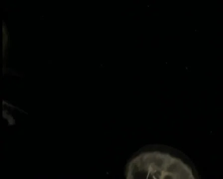 Jellyfish V22 - PAL Stock Footage 10761494