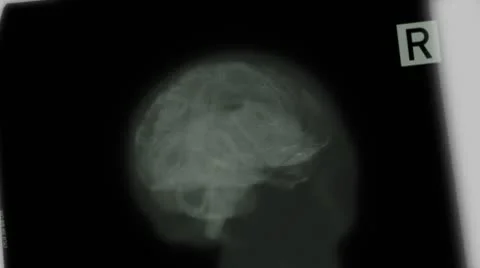 JHD - eMD - Humanoid Brain Video stock 10761487