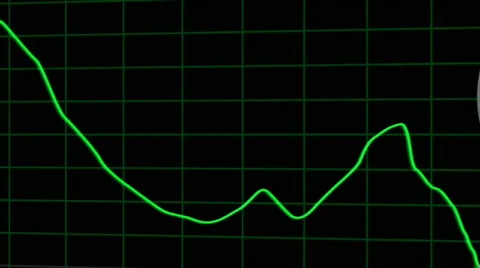 Jittery Dollar Graph Stock-Footage 312547