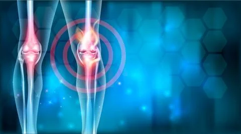 Joint ache Illustrazione stock