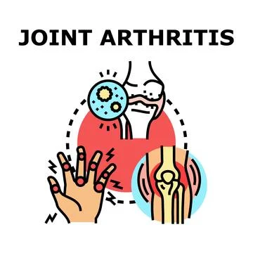 Joint arthritis disease causing pain and inflammation Stock Illustration