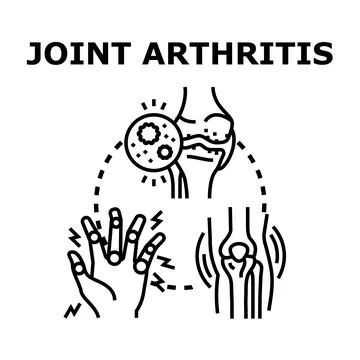 Joint arthritis disease causing pain and inflammation Stock Illustration