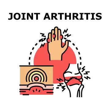 Joint arthritis disease concept vector illustration Stock Illustration
