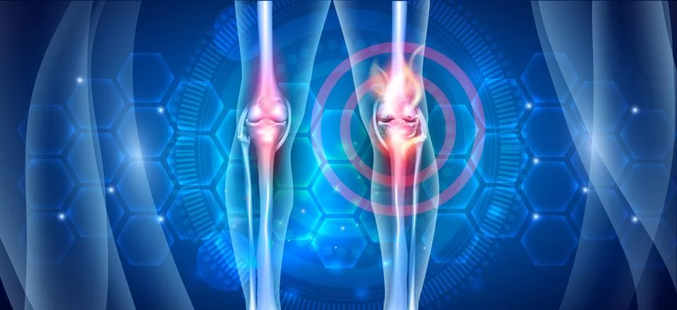 Joint knee problems abstract diagram Illustrazione stock