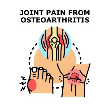 Joint pain from osteoarthritis vector concept illustration Illustrazione stock