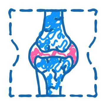 Joint problem flat icon doodle illustration Illustrazione stock