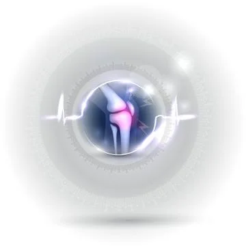 Joint problems and treatment concept Stock Illustration