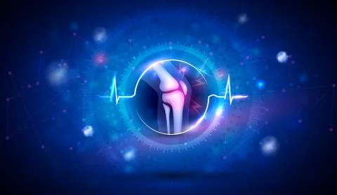 Joint problems and treatment concept Illustrazione stock