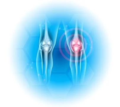 Joint problems illustration Illustrazione stock