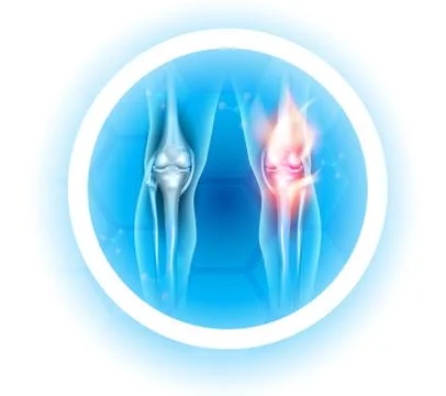 Joint problems symbol Stock Illustration