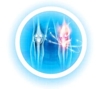 Joint problems symbol Illustrazione stock