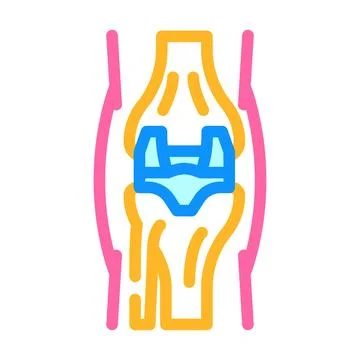 Joint replacement surgery color icon vector illustration Stock Illustration