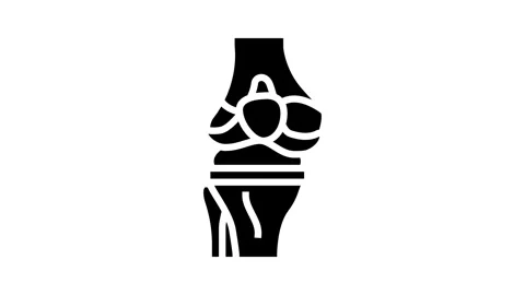 Joint replacement surgery doctor glyph icon animation Stock Footage 326150472