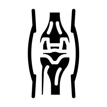 Joint replacement surgery glyph icon vector illustration Stock Illustration